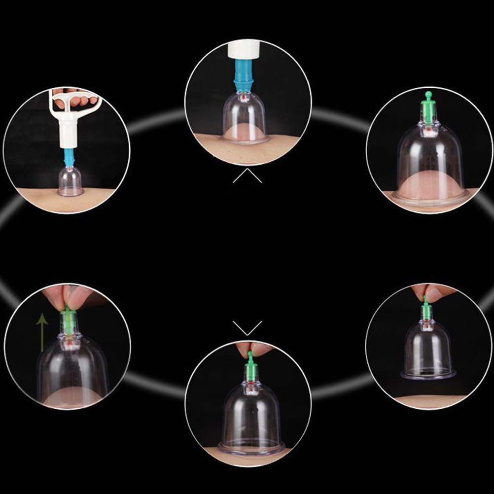 24 Vacuum Cupping Cups Kit Hom – Home Improvement In Usa recenzja i cena